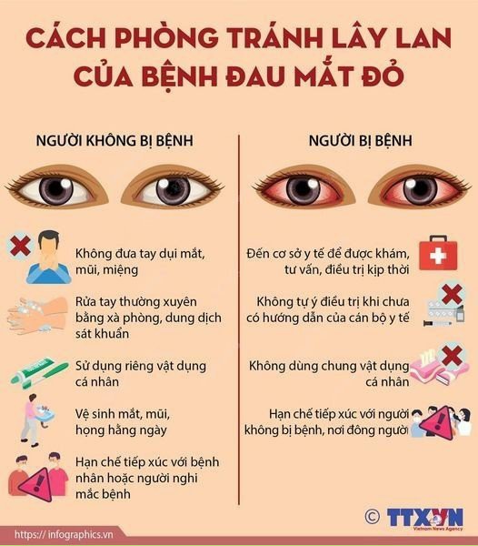 Những biện pháp phòng và điều trị  bệnh đau mắt đỏ